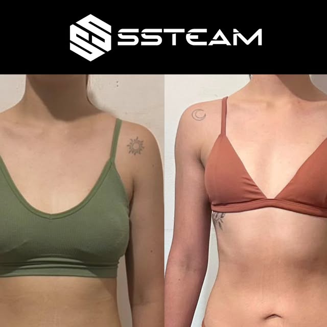 Antes e depois de uma aluna da consultoria online SSTEAM